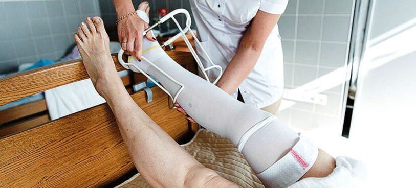 Calze compressive per il trattamento delle vene varicose